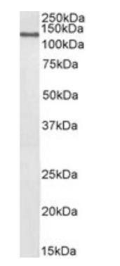 Goat anti-CCAR2 / DBC1 (aa842-855) Antibody