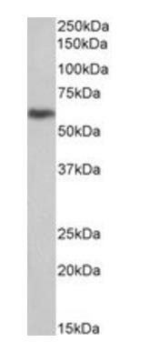 Goat anti-U-PAR / CD87 Antibody