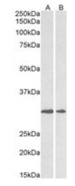 lysyl oxidase Antibody