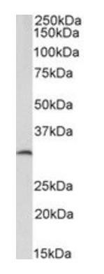 CFD/adipsin (aa87-96) Antibody