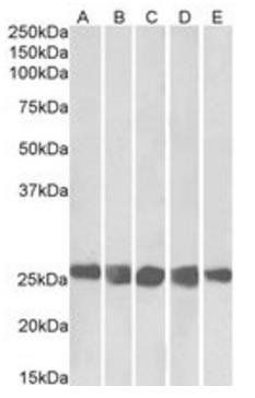Goat anti-CSNK2B (aa172-186) Antibody