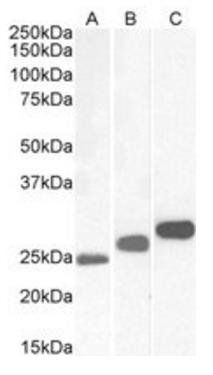 Goat anti-CSNK2B Antibody