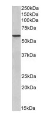 Goat anti-EPHX2 Antibody