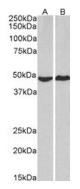 Goat anti-PRKACA Antibody