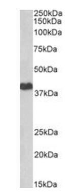 Goat anti-PRKACA Antibody