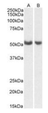 PTGIS/CYP8A1 (aa248-258) Antibody