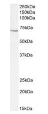 LIMK2 (aa181-193) Antibody