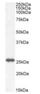 GSTM4 Antibody