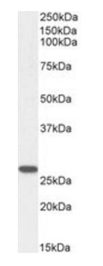 GSTM4 Antibody