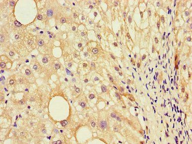 EBI3 Antibody