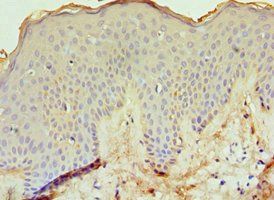 ECE1 Antibody