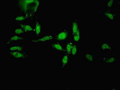 ECEL1 Antibody