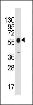 ECGF1 antibody