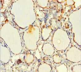 Echinoderm microtubule-associated protein-like 2 antibody