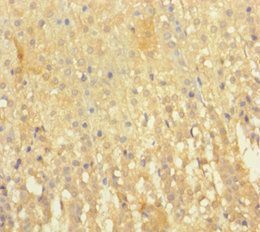 EML2 Antibody