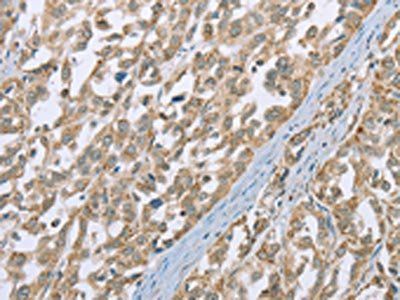 ECHS1 Antibody