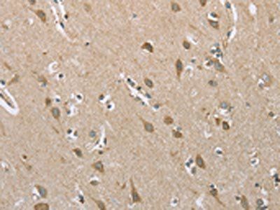 ECHS1 Antibody