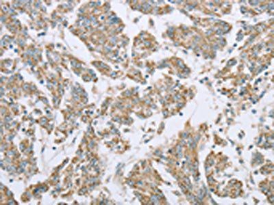 ECHS1 Antibody