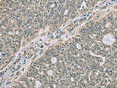 RNASE3 Antibody