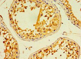 EDA2R Antibody