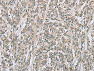 EDA2R Antibody