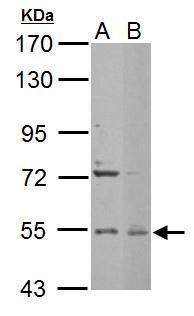 enhancer of mRNA decapping 3 Antibody
