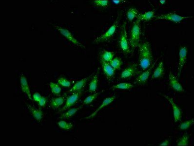 EDC4 Antibody