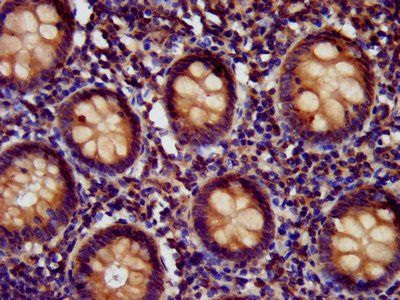 EDC4 Antibody