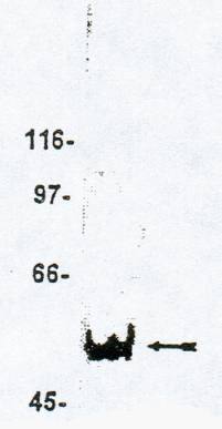 Rabbit Human Lysophosphatidic Acid Receptor 1 CT (EDG-2) Antibody