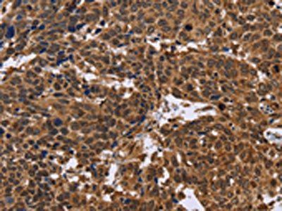 EDN2 Antibody