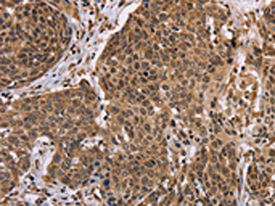 EDN2 Antibody