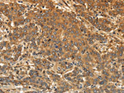 EDNRA Antibody