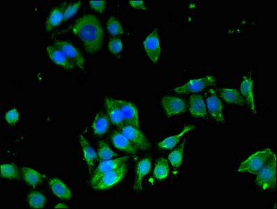 EDNRB antibody