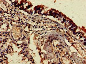 EDNRB antibody