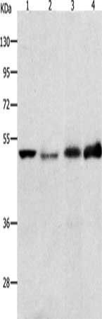 EDNRB antibody