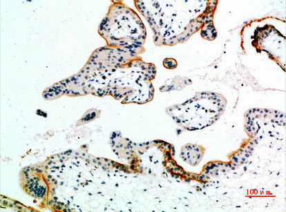 EDNRB antibody