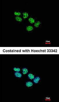 EED antibody