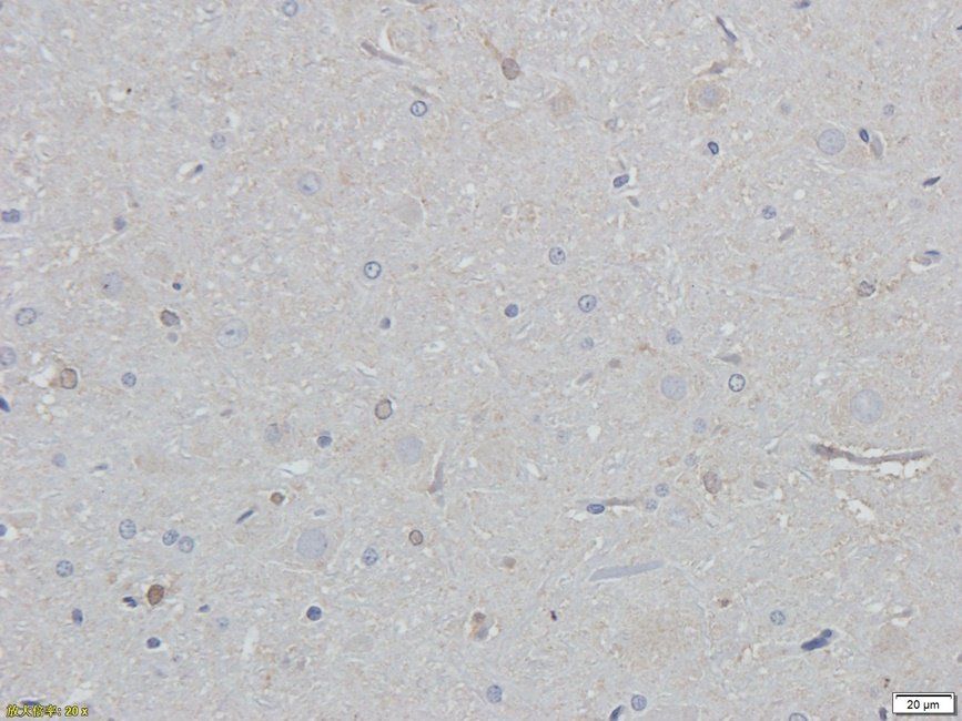 eEF2 antibody