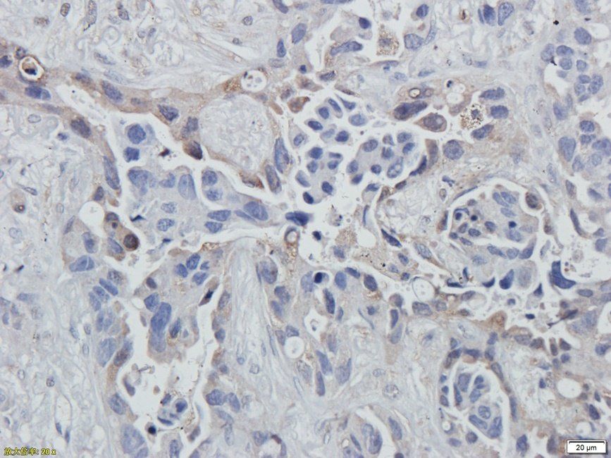 eEF2 antibody