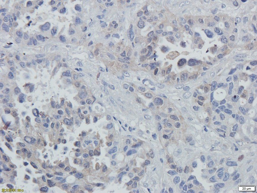 eEF2 antibody