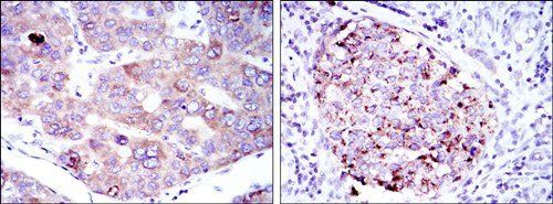 EEF2 Antibody