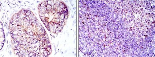 EEF2 Antibody