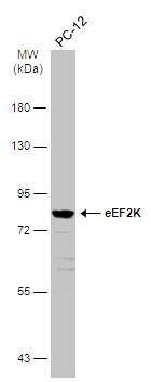 eEF2K antibody [N1N3]