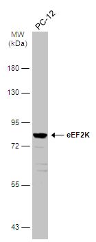 eEF2K antibody