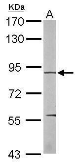 eEF2K antibody