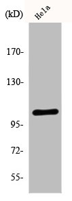 EEF2K Antibody
