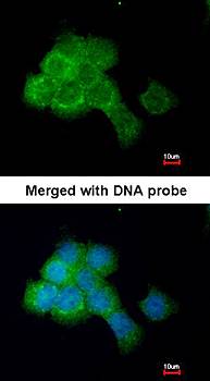 EEF2K antibody