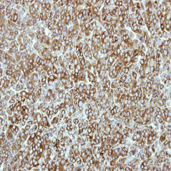 EEF2K antibody