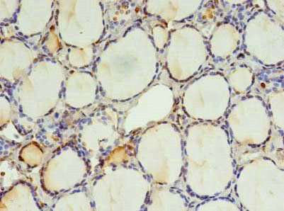EFCAB14 Antibody