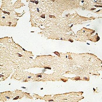 EFCAB1 Rabbit Polyclonal Antibody